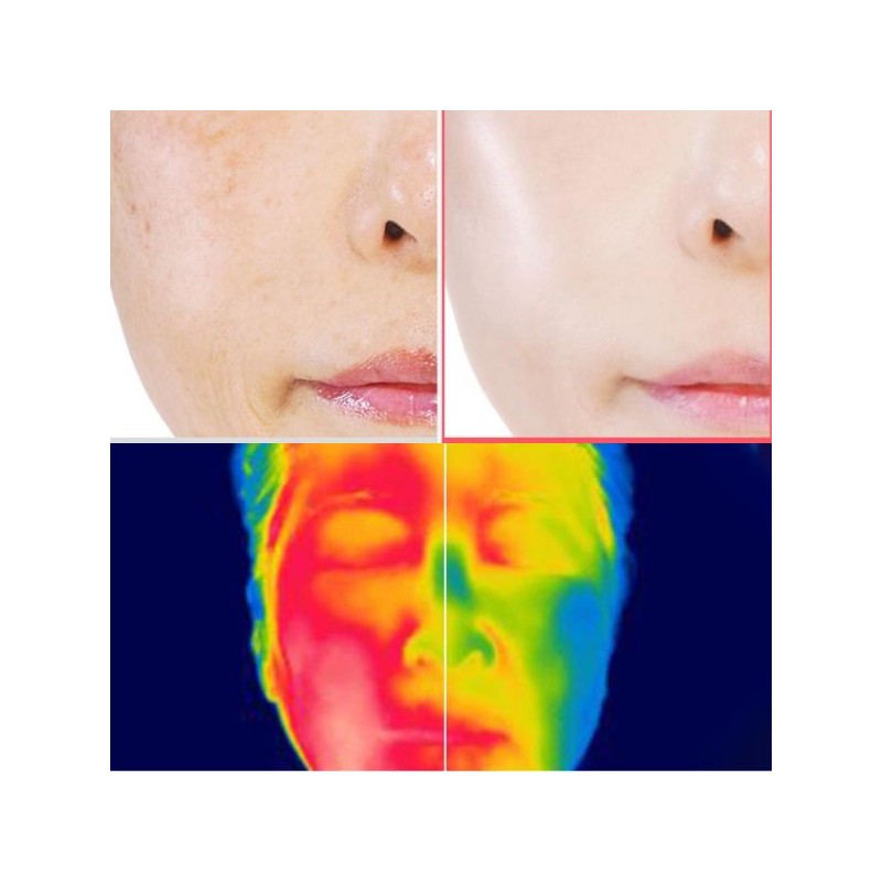 ELROEL Blanc Cover Mela Stick 4X PA++++ 11mg