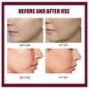 Delicate facial care solution