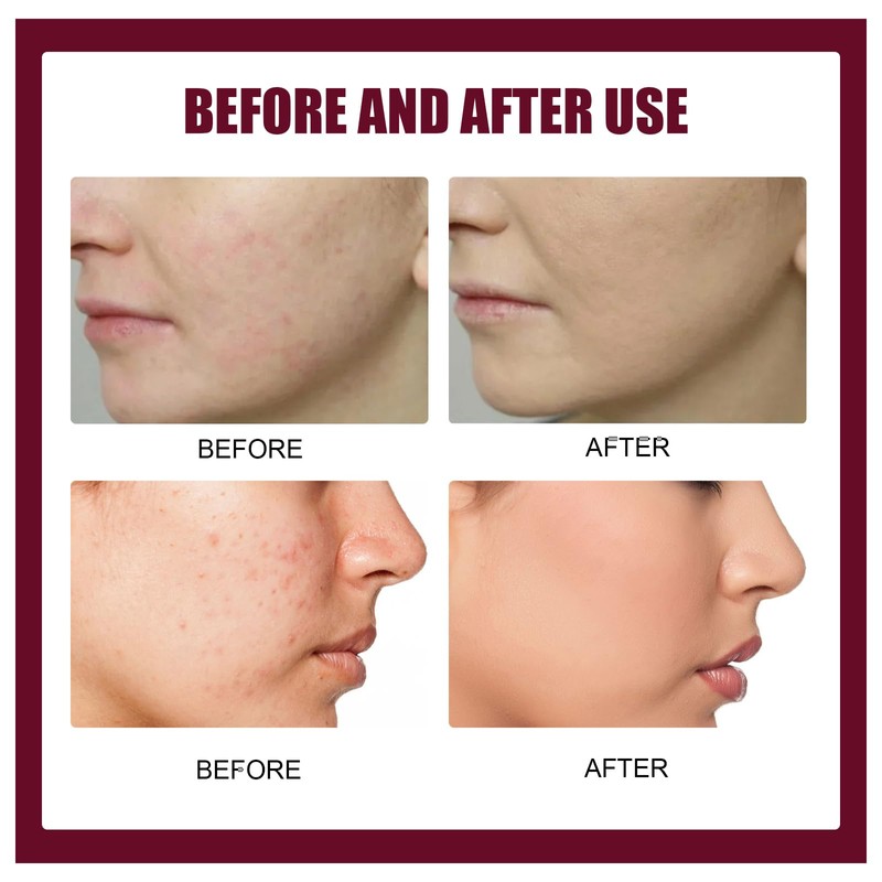 Delicate facial care solution