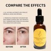Frankincense Resin Oil For Face, Frankincense Resin Infused Oil, Facial