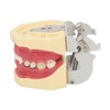 Periodontal Disease Teeth Resin Model Dental Demonstration Teeth Model for