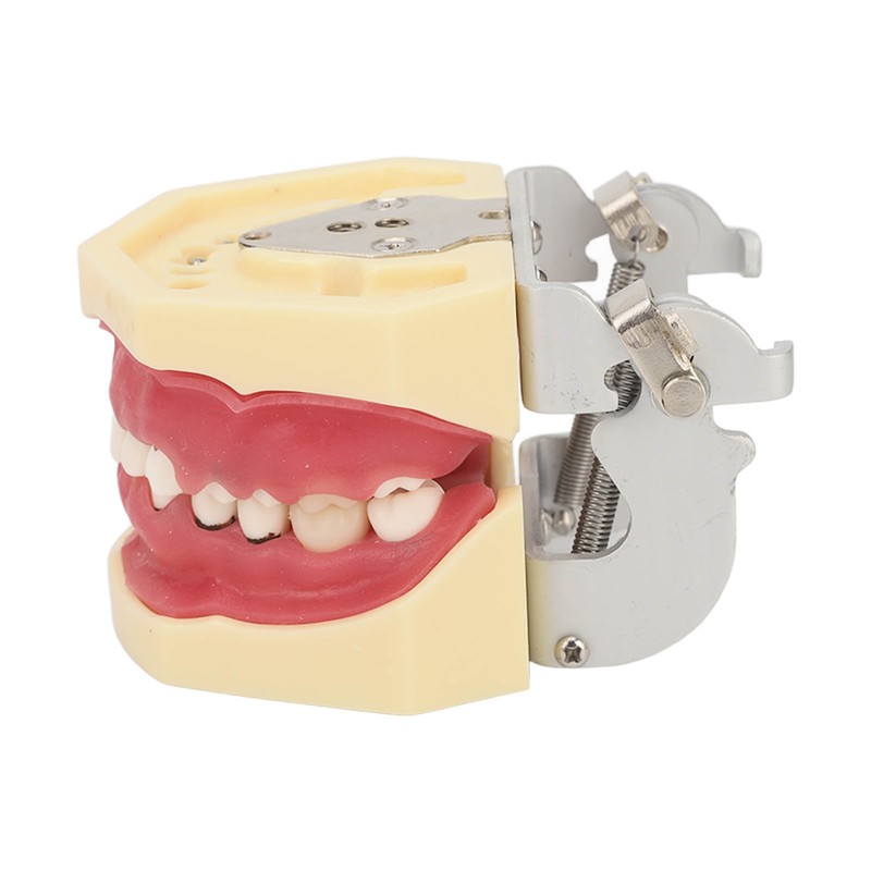 Periodontal Disease Teeth Resin Model Dental Demonstration Teeth Model for