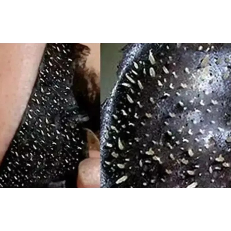 10 Cuidado Facial Mascarilla Negra Carbón Act Puntos Negros Todo