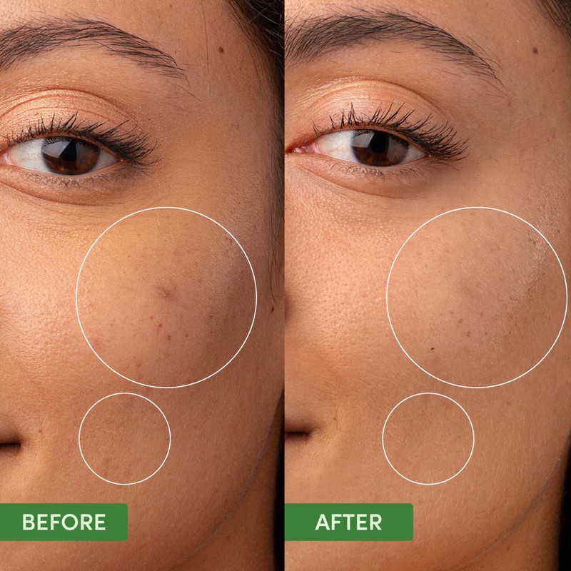 Sand & Sky Oil Control Clearing Moisturiser 60g