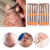 Exfoliating Ingrown Toenail Removal Pedicure Knife,Decorative Foot Knives for Ingrown