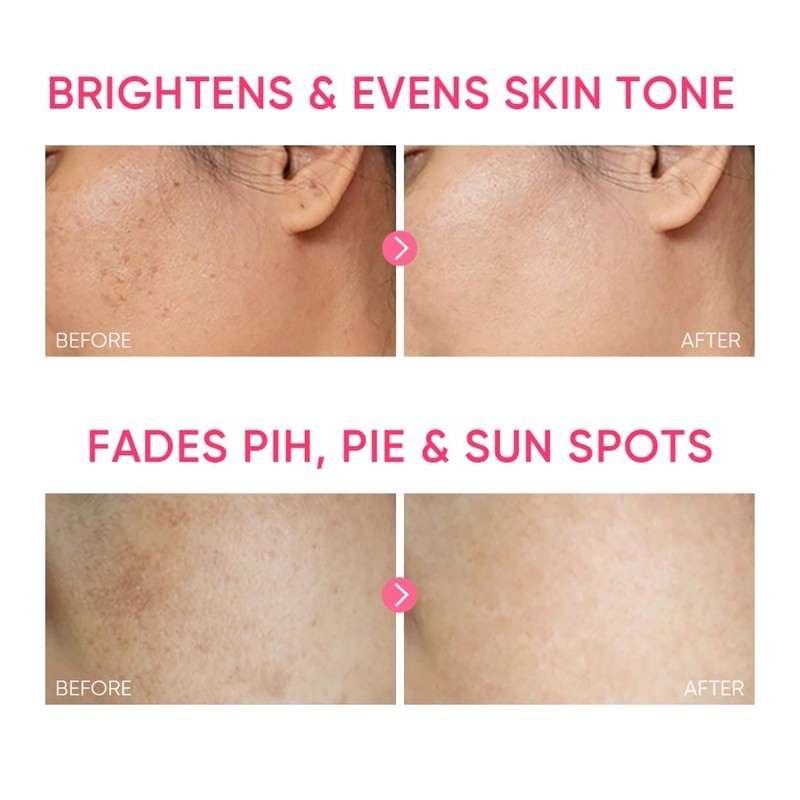 SKINTIFIC MSH Niacinamide Brightening Moisture Gel, Skin Tone Evening, Dark