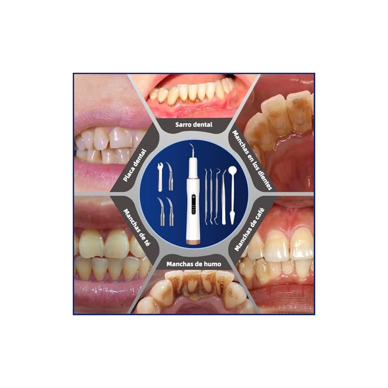 Limpiador Dental Ultrasónico 5 Modos IPX7