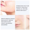 AICHUN BEAUTY 12.5% Vitamin C Face Serum Moisturizing Anti-Freckle Anti-Aging