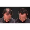 LUXE Hair Building Fibers - Thickening Fibers - CONFIDENCE IN