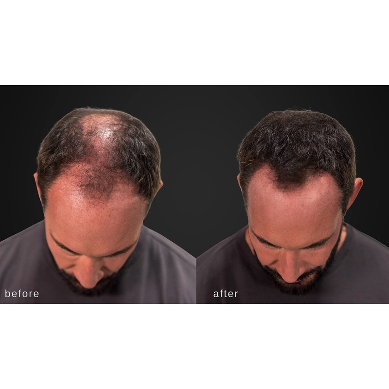 LUXE Hair Building Fibers - Thickening Fibers - CONFIDENCE IN