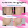 EQQUALBERRY Suero Facial NAD+ 14 Péptidos y Ceramidas 30 ml