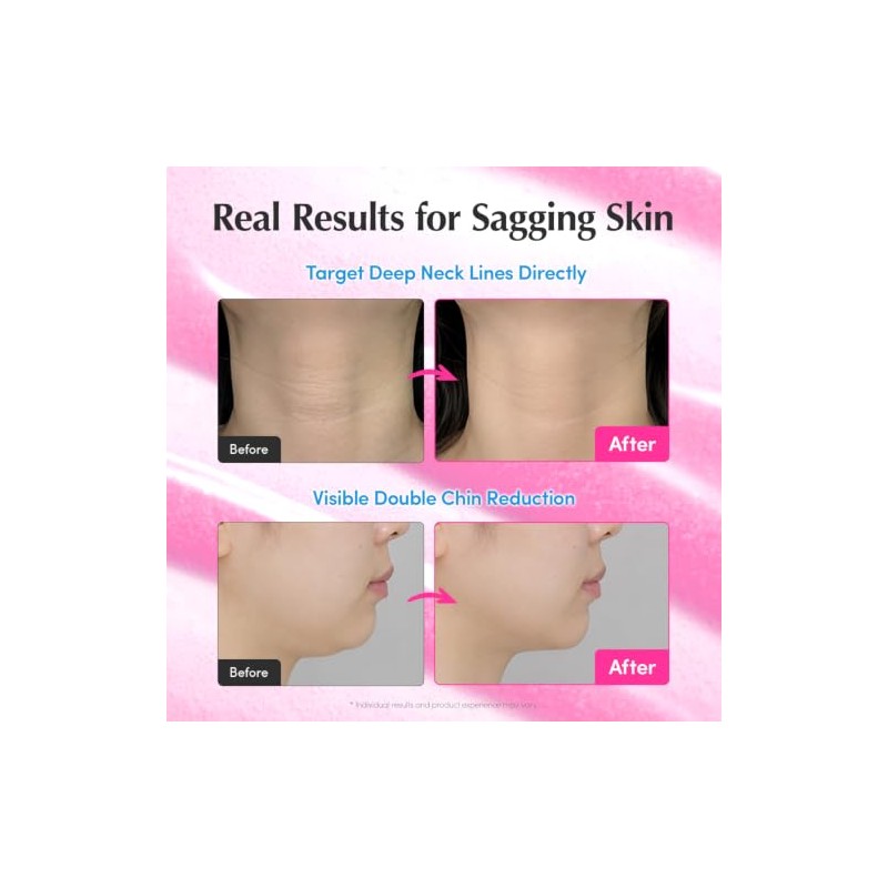 EQQUALBERRY Suero Facial NAD+ 14 Péptidos y Ceramidas 30 ml