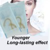 CeFurisy Collagen Silk Threads for Lifting Thread Lifting for Skin