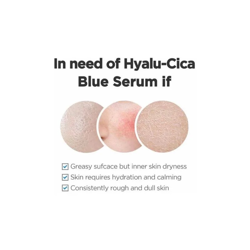 Skin1004 Madagascar Centella Hyalu-cica Blue Serum 50ml Todo Tipo De