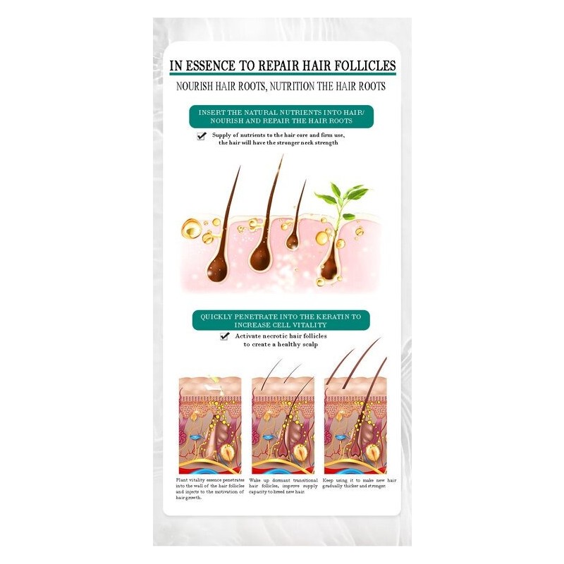 Natural Zenshow Ginger Hair Loss Shampoo Serum Control Oil Strong