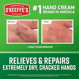 Crema de manos O'Keeffe's Working Hands en un frasco con bomba para sequedad extrema – Bomba de 10oz (1 paquete) - Cuidado de la piel reparador para m