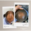 Tonico Vittale Acondicionador Para Cabello Lacio | Efecto Lacio |