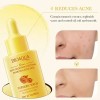 Serum De Cúrcuma Bioaqua Ácido Hialurónico Antioxidante