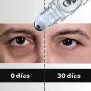 Kit Anti Ojeras Y Arrugas Roll On + Serum Antiedad