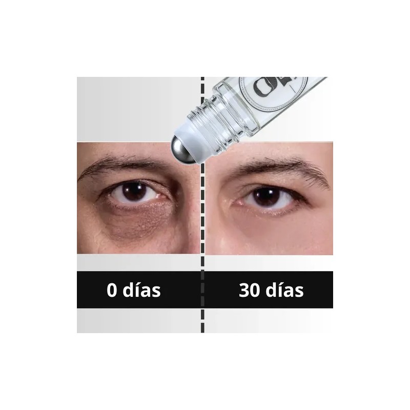 Kit Anti Ojeras Y Arrugas Roll On + Serum Antiedad