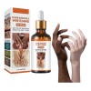 Serum Despigmentante Aclarante Axilas Pezon Codos Intimo 50g