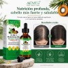 Aceite 3 En 1 Romero Ricino Negro Batana Anticaída Capilar