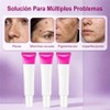 3Pzs Skin Moisturizer Crema Despigmentante Facial