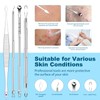 20 pcs Pimple Popper Tool Kit, Black Head Remover for