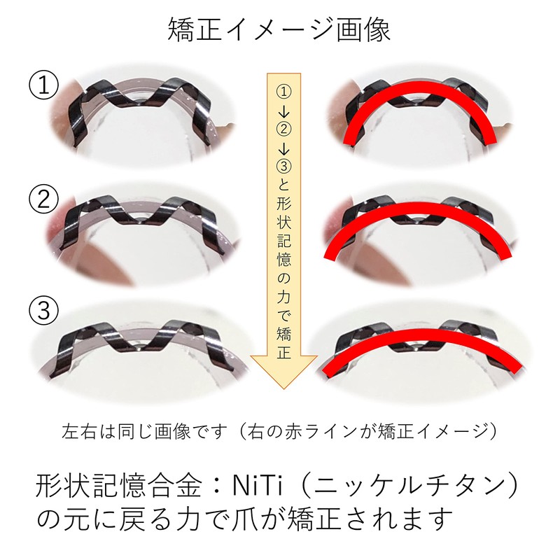 Nail Aid 0.6 inch (14 mm) Winding Nail Correction Self-Winding