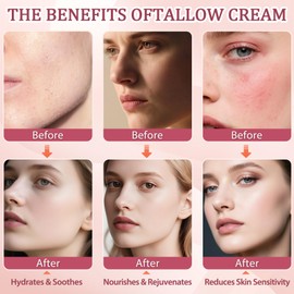 GARPGONA Beef Tallow for Skin, Whipped Tallow Cream for Face Moisturizer, 102% Grass Fed, Deeply Nourishing for Body, Smooth Soft for Dry Skin (Cloud)