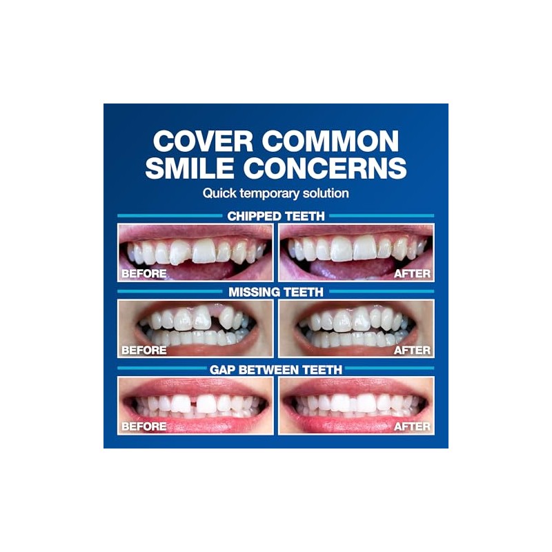 Imako Cosmetic Teeth Extras (Tooth Tinted Plastic)- Natural Color by