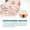 1 Acne Patch Star, Tea Tree Oil Spot Sticker, Water