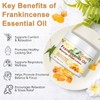 LTQXGT Frankincense Balm for Skin, Feet & Body – Deep