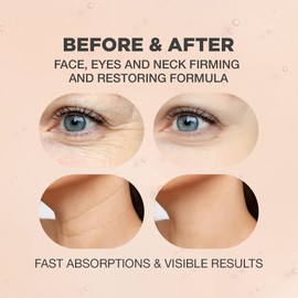 PROOT Ginseng Serum | Ginseng Serum with 52.5% Korean Ginseng Extract | Korean Ginseng Serum Formulated with Ginseng Extract, Hyaluronic Acid & WGF Complex-3 | Korean Ginseng Skin Care Technology