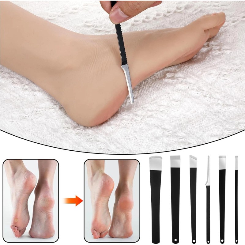 Gtziqa 6 Pcs Ingrown Toenail Removal Kit Pedicure Tools with