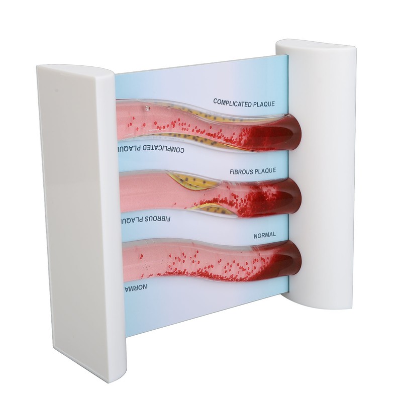 Lipoprotein LDL Blood Vessel Model Low Density Blood Lipid Vessel