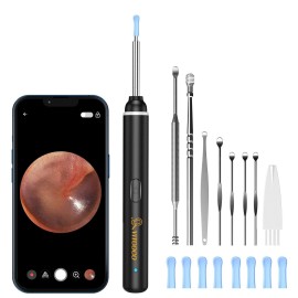 VITCOCO HD Ear Scope with Camera - 1920P WiFi Otoscope Kit with LED Lights & Spoons