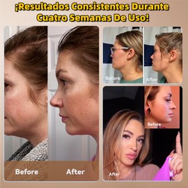 Faja Papada, con Cinta de Lifting Facial 24PCS, Correa Facial V-Lifting, Faja Facial Mujer, Reutilizable Eliminador de Papada, Bandas Faciales de Tonificación, Reafirmar con Efecto Antiarrugas, Negro
