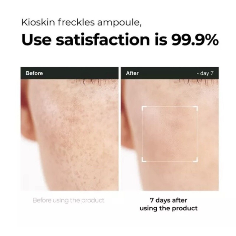 KIOSKIN L-Cysteine Melacare Ampoule 10ml 4EA Powerful Melasma Treatment K-Beauty