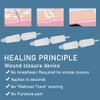 Wound Closure Strips 3PCS Butterfly Wound Closure Suture Strip Butterfly