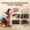 Shampoo Anticaída Y Anticaspa 300ml Cabello Normal A Graso