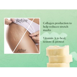 White Naturals Bulk Shea Butter 5 lb By White Naturals - Unrefined, 100% Pure, Raw, Grade A