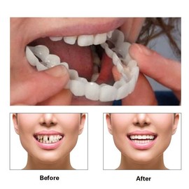 2 Pairs, Temporary Nature and Comfortable to Regain Confident Smile