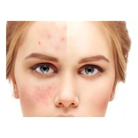 Caviar Serum Crema Caviar Regenera Ojera Arruga 100% Original 100ml