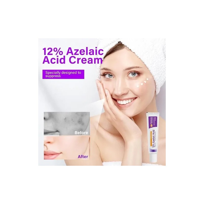 Creme De Ácido Azelaico Essência Facial 12% 20g Anti-acne