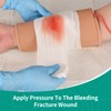 MedEduQuest Open Fracture Wound Packing Trainer, Wound Dressing Training Model,