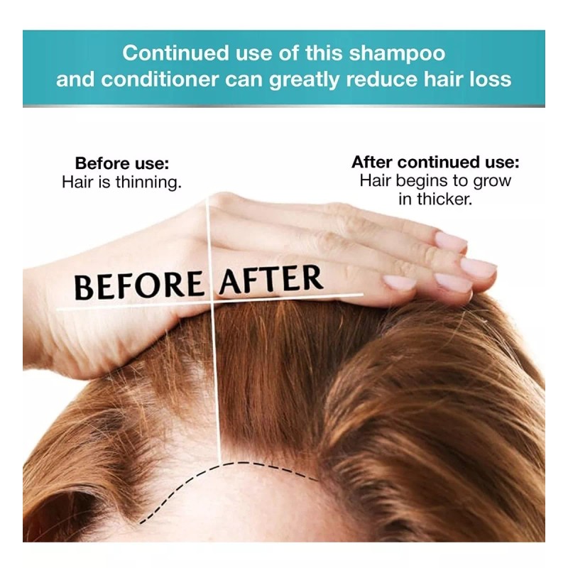 Bellisso Juego De Champú Y Acondicionador De Biotina Para El