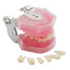 Dental Demonstration Teeth Model - Tooth Extraction Model Standard Study