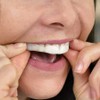SleepRight Gen 2 Pro-RX - Protector dental (nueva versión)