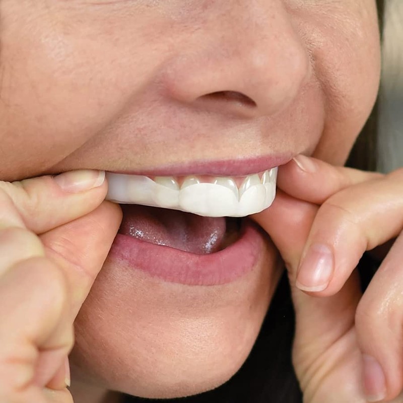 SleepRight Gen 2 Pro-RX - Protector dental (nueva versión)